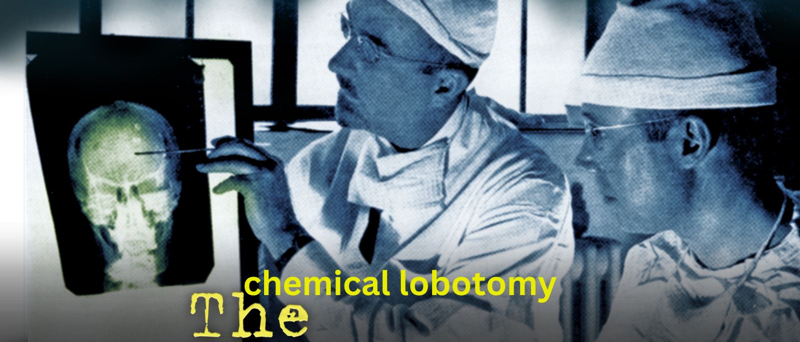 what is a chemical lobotomy